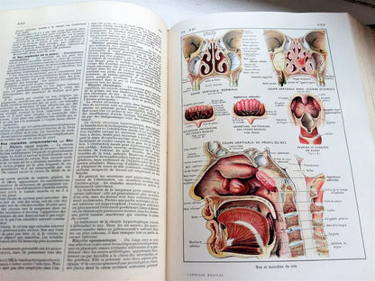 Medical Dictionary. 1924 Larousse Médical Illustré from Tiggy & Pip - Just €149! Shop now at Tiggy and Pip
